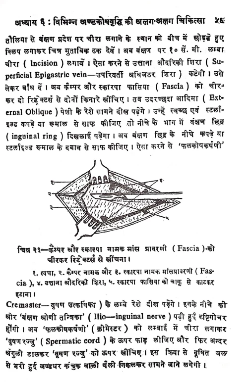 Hydrocele Aur Hernia Operation